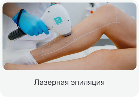 Лазерная эпиляция