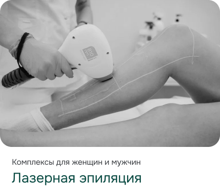 Лазерная эпиляция