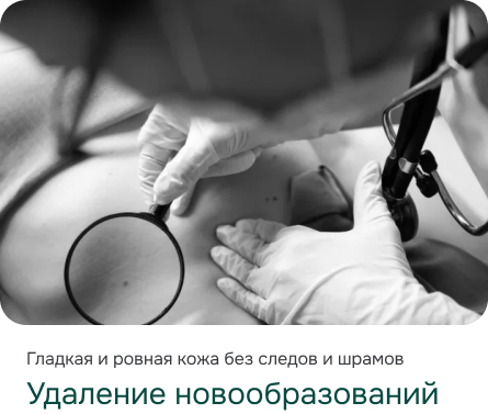 Удаление новообразований